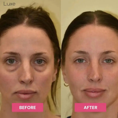 Luxe - Korean Under-Eye Balm Luxe Research